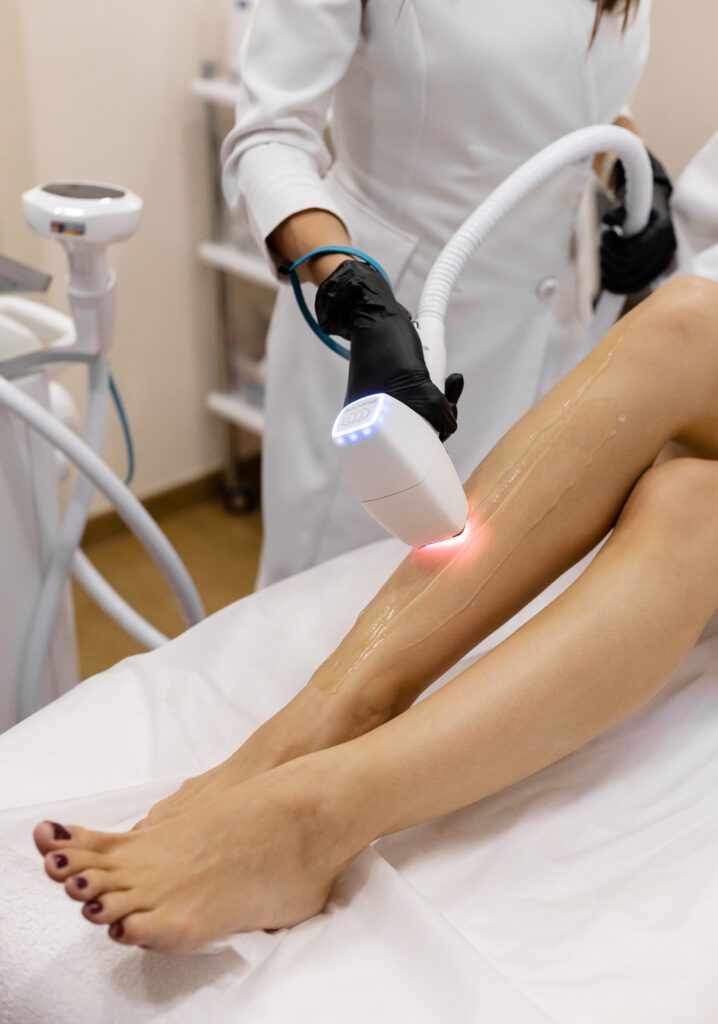 Лазерная эпиляция Diolaze XL